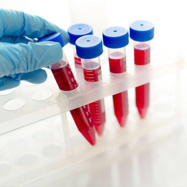 covid-fiorenzuola-test-anticorpi-neutralizzanti-2-covid-19