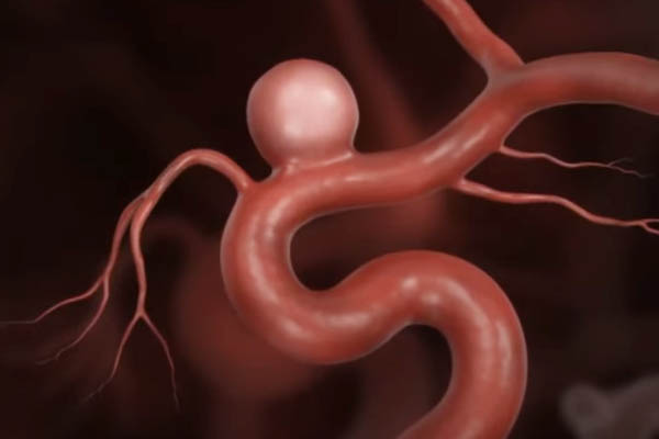 patologie-neurovascolari-visita-neurochirurgica-fiorenzuola-neurochirurgo